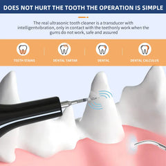 Ultrasonic Electric Dog Toothbrush | Professional Pet Plaque & Tartar Remover | Teeth Whitening & Dental Care